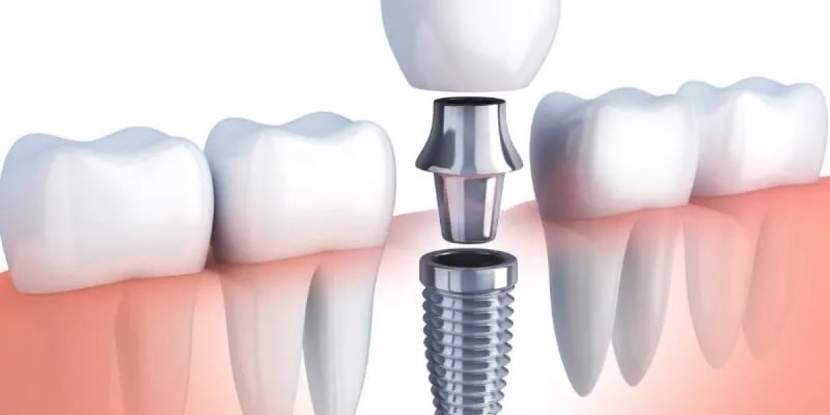 Comprehensive Oral Surgery Services in McKinney, TX: Restoring Oral Health with Precision and Care